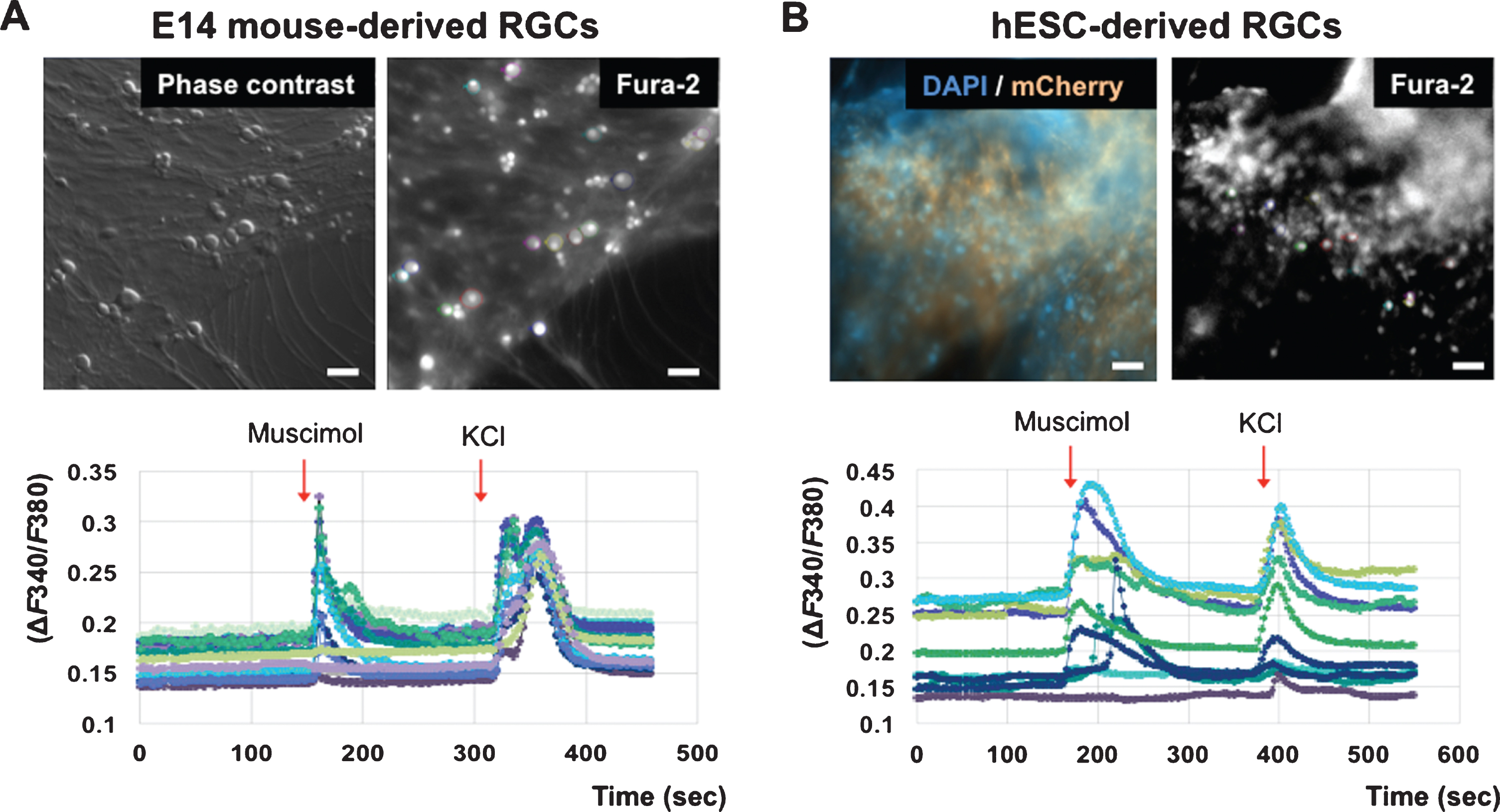 Cell Transplantation Of Retinal Ganglion Cells Derived From HESCs IOS