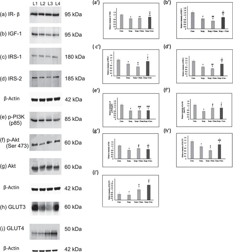 Curcumin Ameliorates The Impaired Insulin Signaling Involved In The Pathogenesis Of Alzheimer S Disease In Rats Ios Press