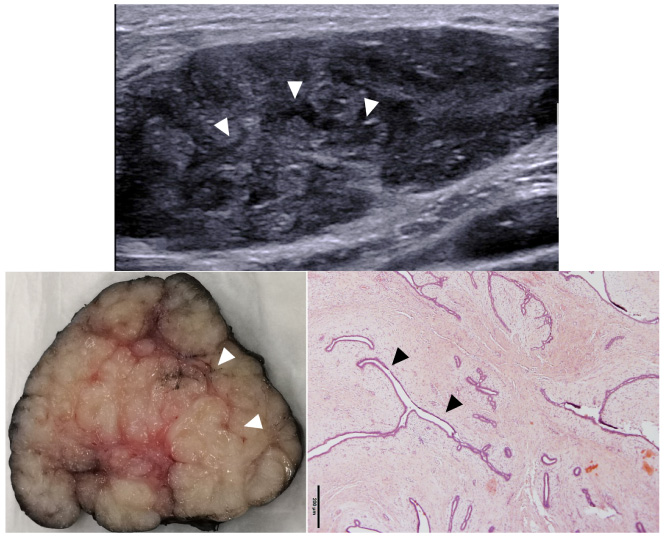 An integrative ultrasound-pathology approach to improve preoperative ...