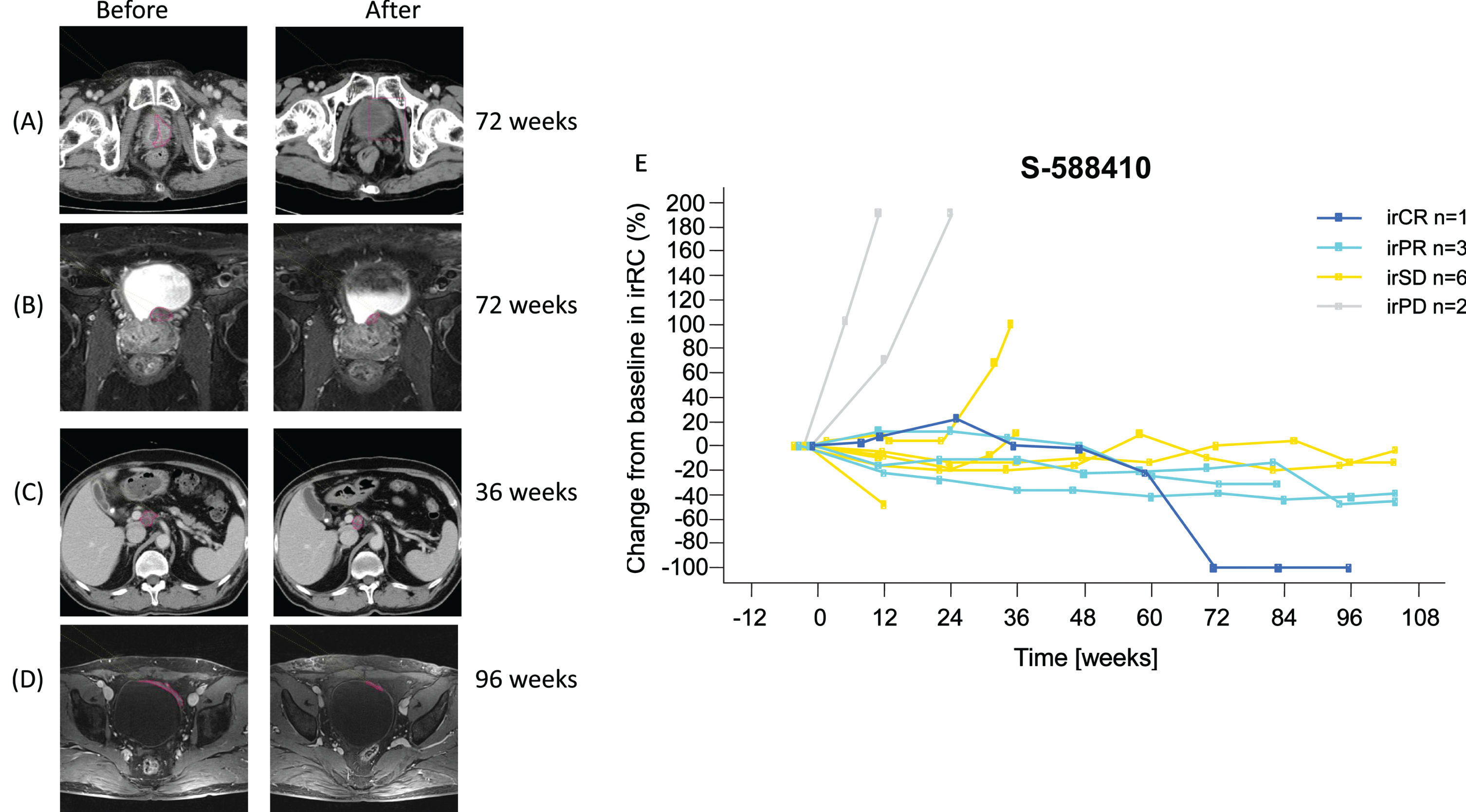 A Phase 2 Study of S-588410 Maintenance Monotherapy for Platinum