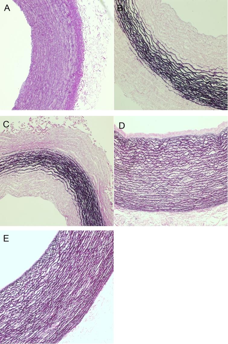 Triton X-100 combines with chymotrypsin: A more promising protocol to ...