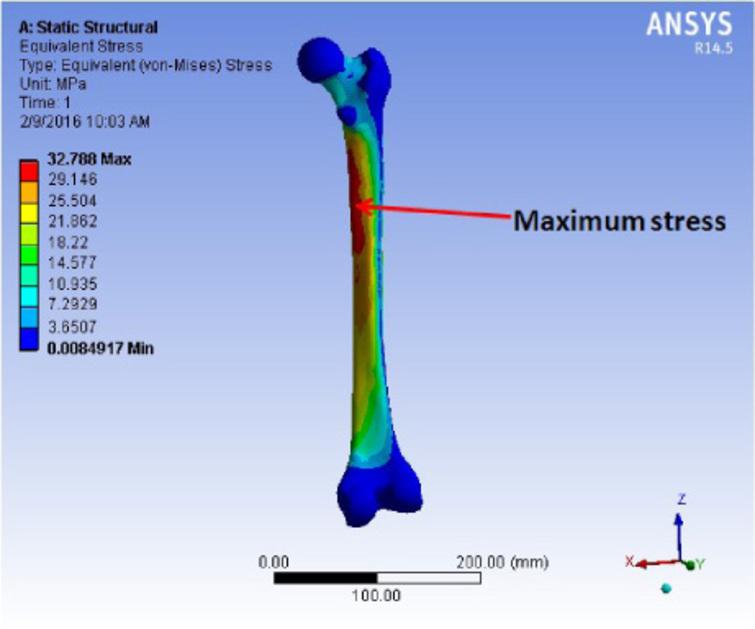 Optimization of the configuration of porous bone scaffolds made of ...