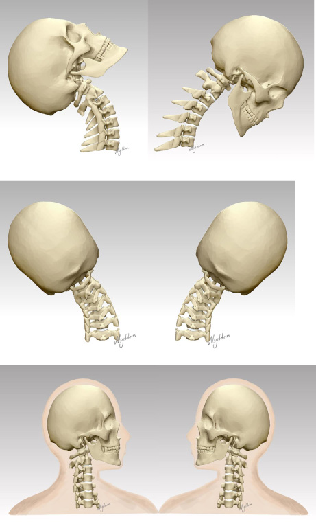 3d x ray upper cervical spine