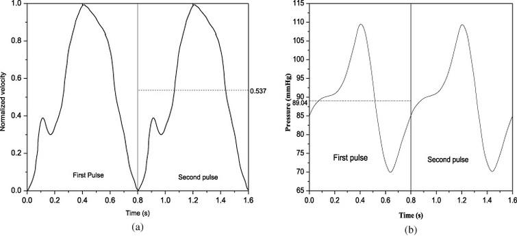 Influence of bifurcation angle in left coronary artery with stenosis: A ...