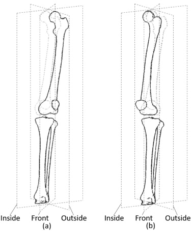 New evaluation indices for rotational knee angles in standing ...