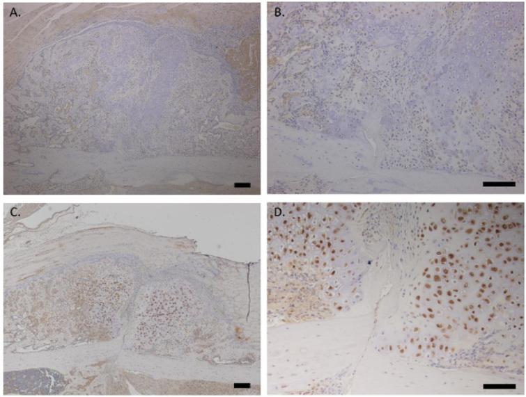 Expression of nerve growth factor in the callus during fracture healing ...