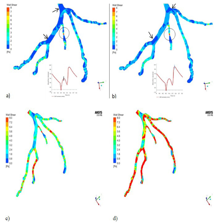 Visualization of multiphase pulsatile blood over single phase blood ...