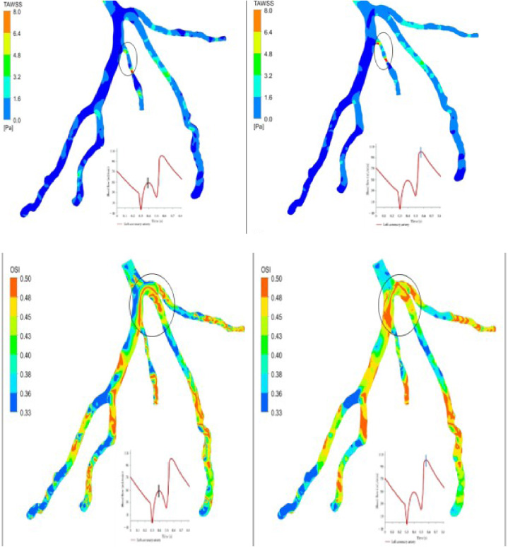 Visualization of multiphase pulsatile blood over single phase blood ...