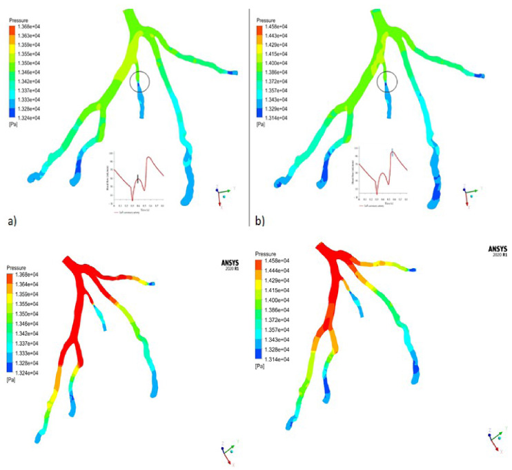 Visualization of multiphase pulsatile blood over single phase blood ...