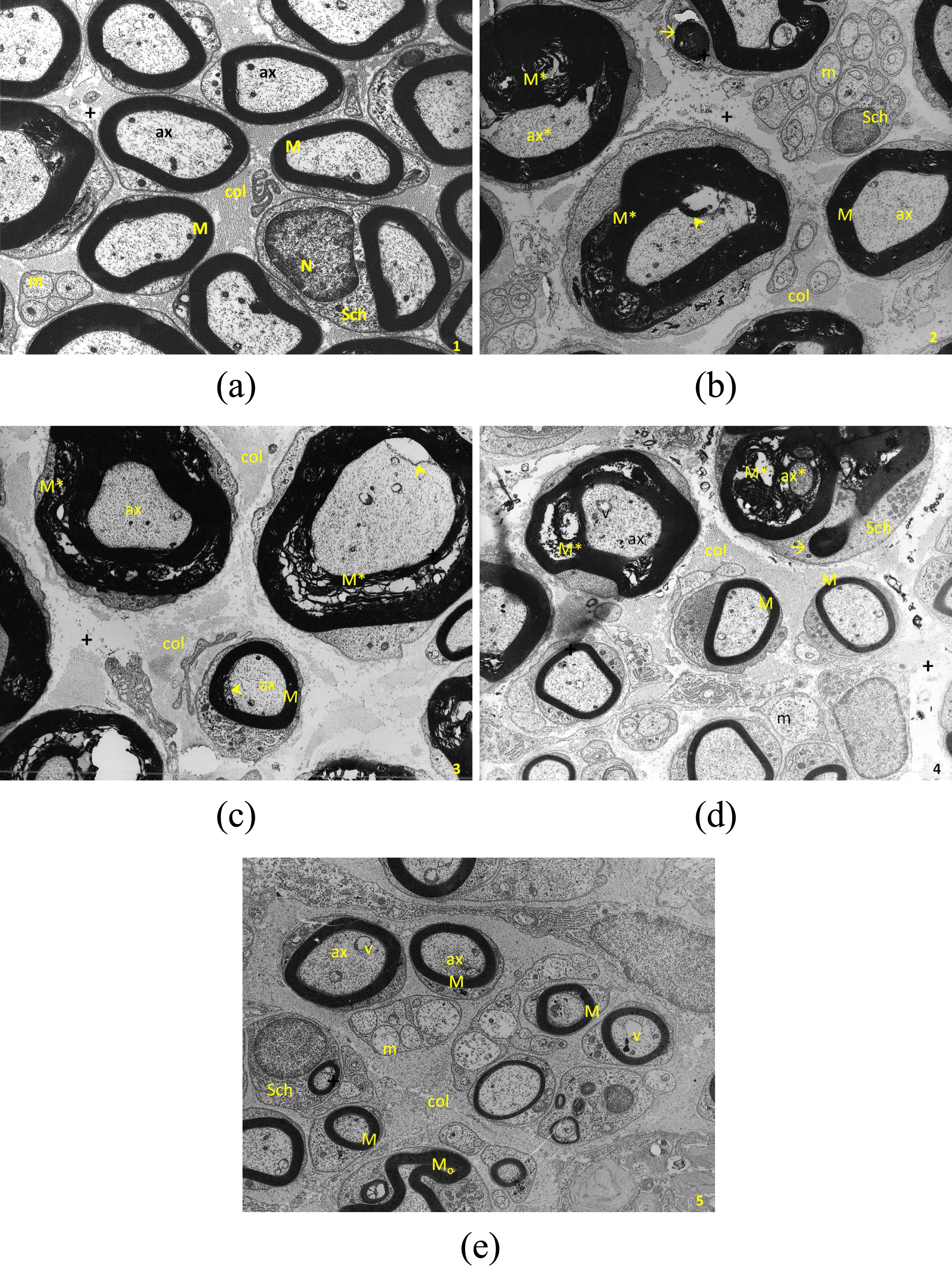 Comparative Evaluation Of The Electrophysiological, Functional And ...