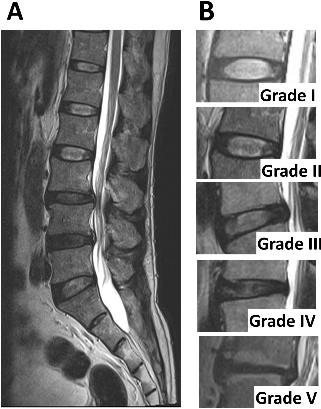 Acute Effects Of Kinesio Taping On Pain, Disability And Back Extensor ...