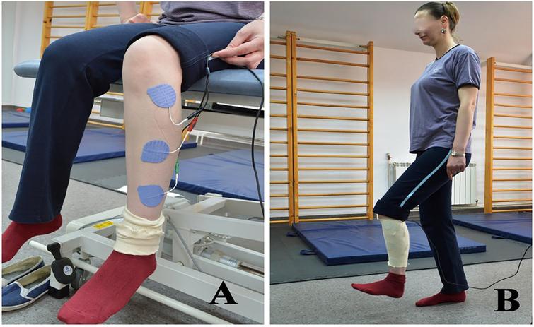 Effects of biofeedback versus switch-triggered functional electrical ...