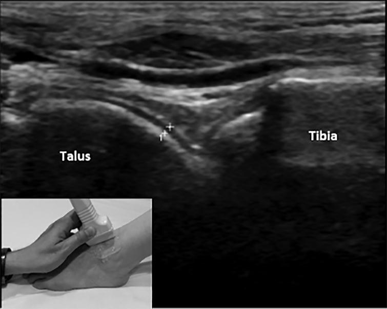 Ultrasonographic measurements of the metacarpophalangeal and talar ...