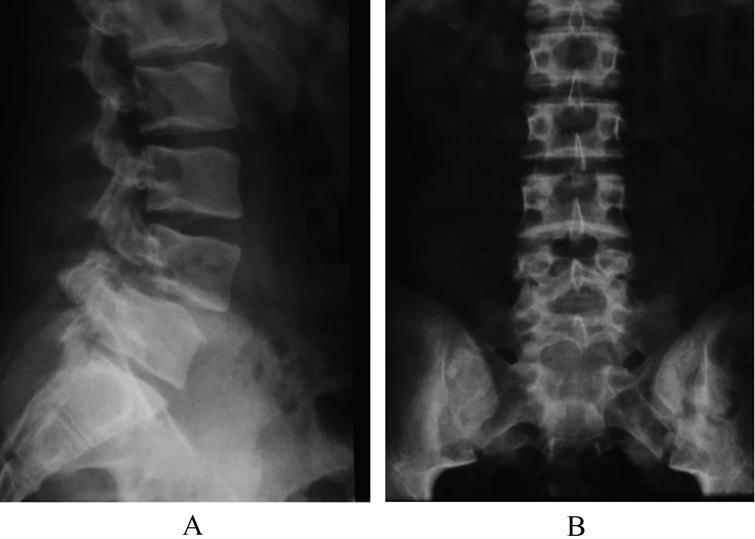 Evaluation and management of paediatric and adolescent back pain ...