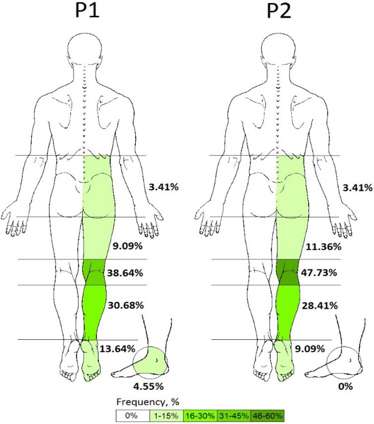 Normal response to tibial neurodynamic test in asymptomatic subjects ...