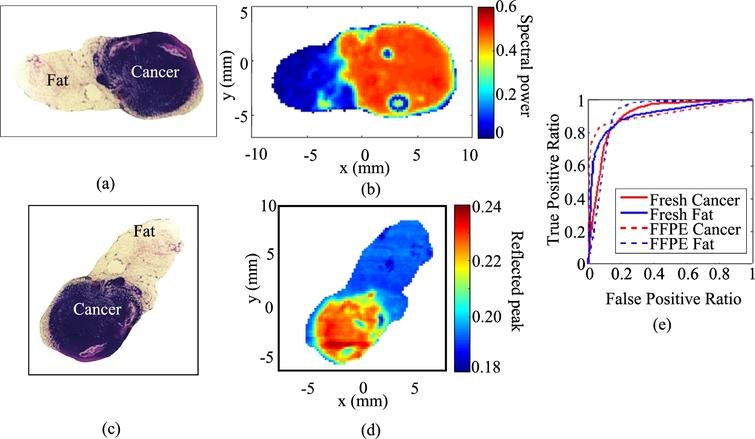 Cancer Detection In Excised Breast Tumors Using Terahertz Imaging And Spectroscopy Ios Press 1156