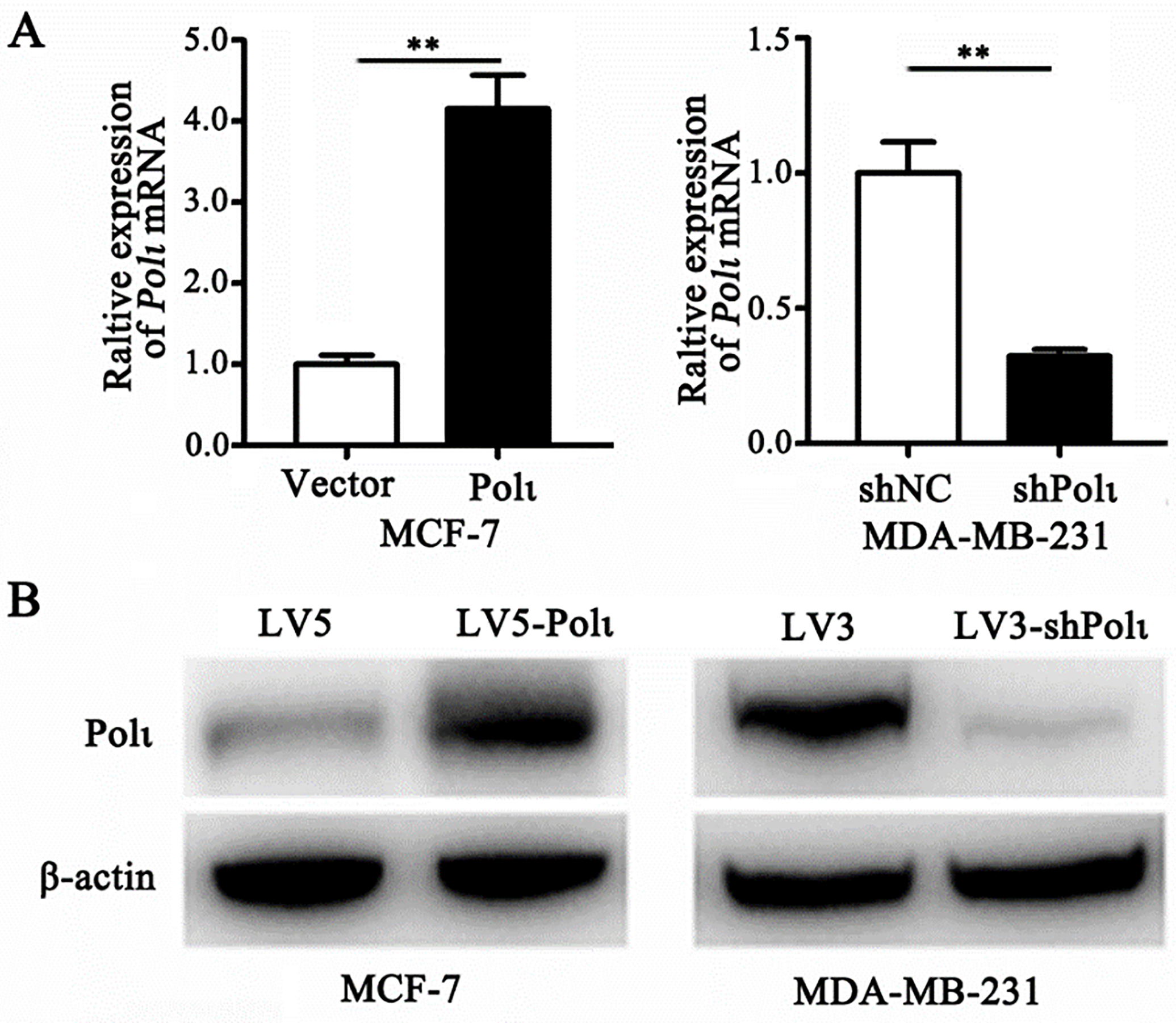 Dna Polymerase Iota Pol ι Promotes The Migration And Invasion Of Breast Cancer Cell Via Egfr 5773