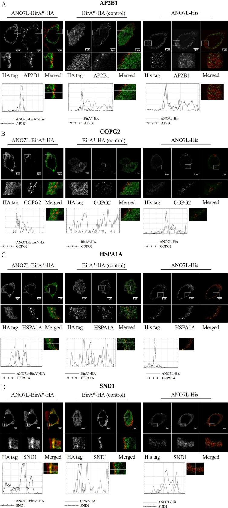 The Interactome Of The Prostate Specific Protein Anoctamin 7 Ios Press