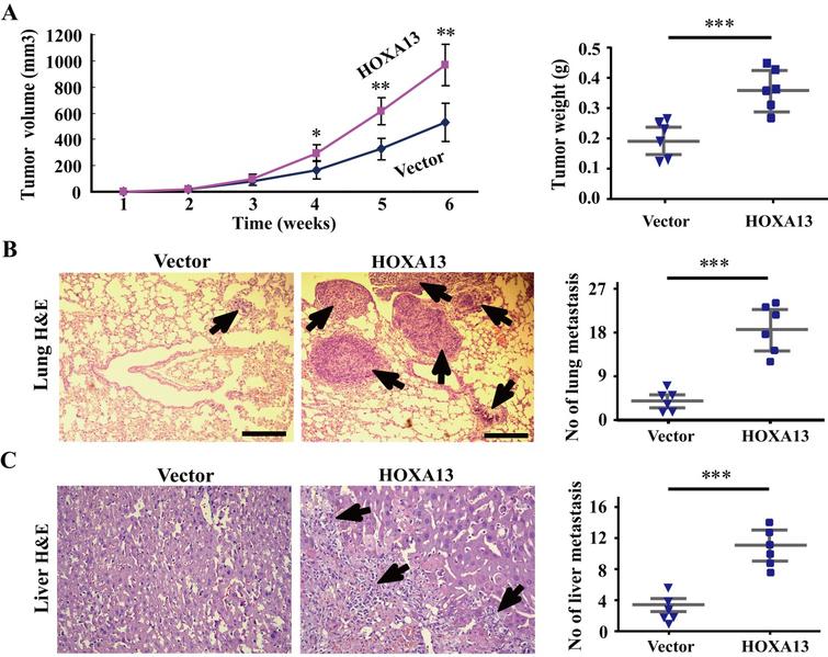 Homeobox-A13 acts as a functional prognostic and diagnostic biomarker