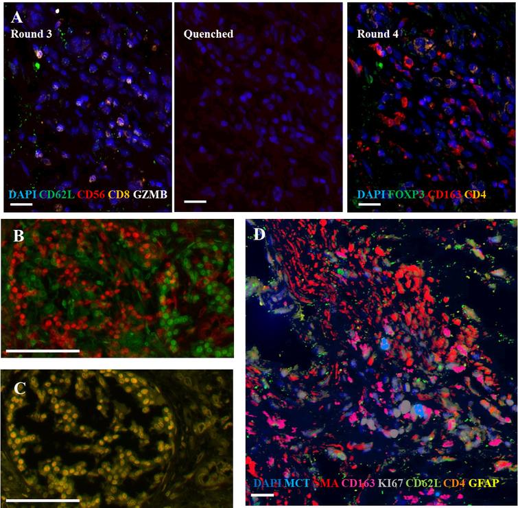 Machine learning analyses of highly-multiplexed immunofluorescence ...