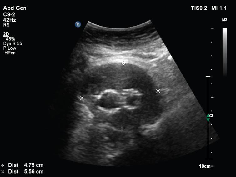 Comparison Of Portable Ultrasound System And High End Ultrasound System 