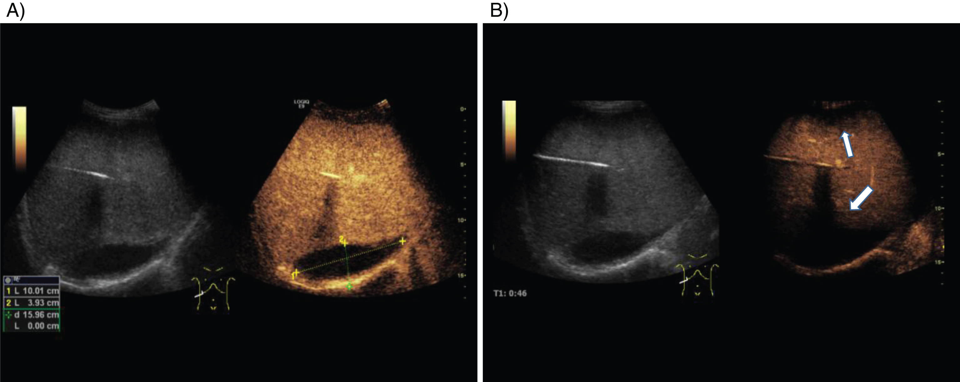 Contrast-enhanced Ultrasound (CEUS) In An Interdisciplinary Intensive ...