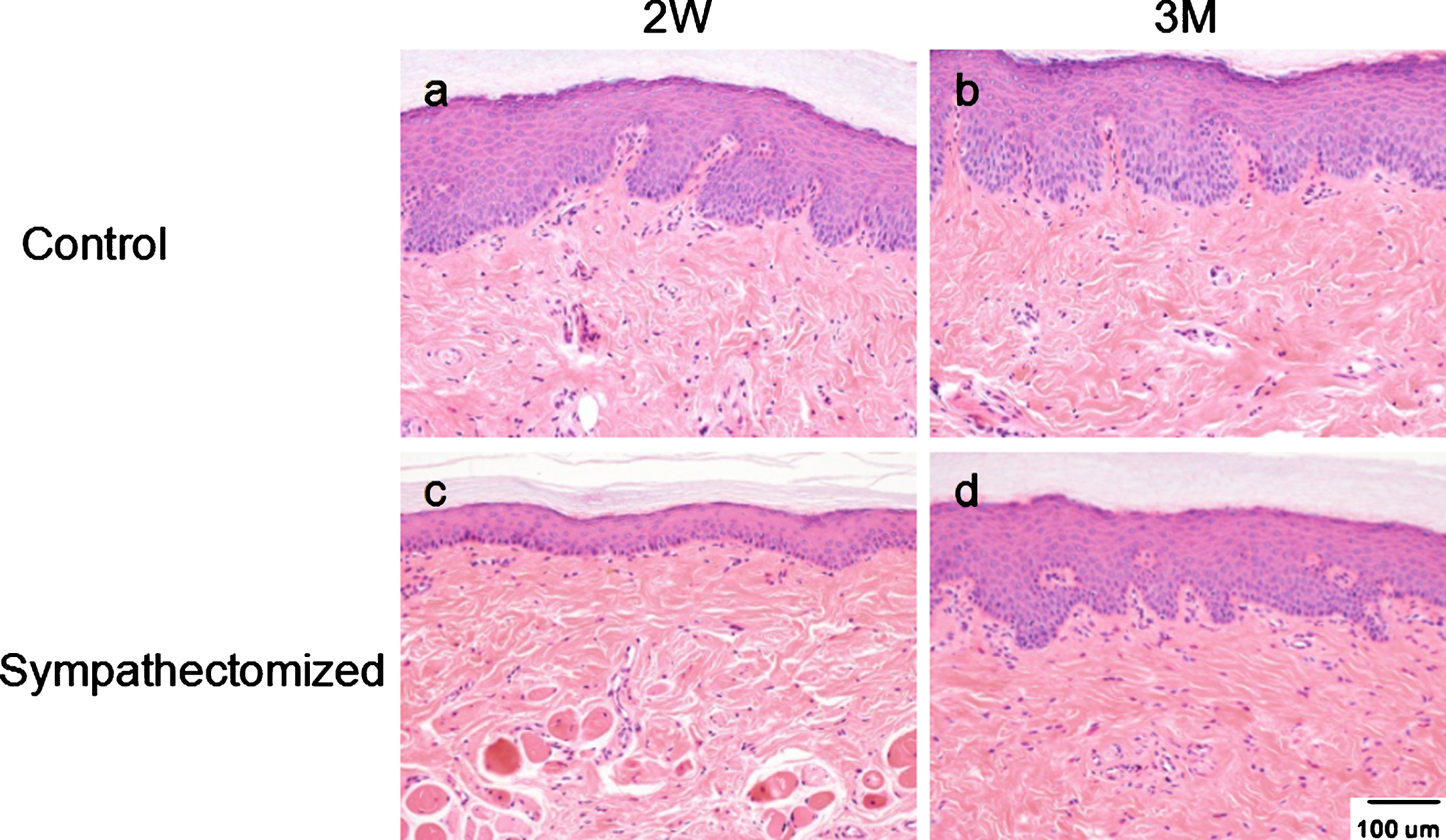 Lumbar Sympathectomy Regulates Vascular Cell Turnover In Rat Hindfoot ...