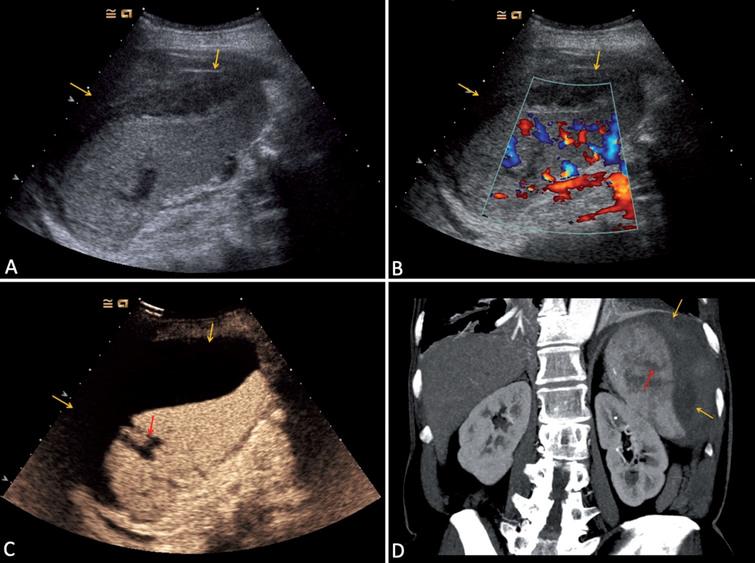 Single-center study: The diagnostic performance of contrast-enhanced ...