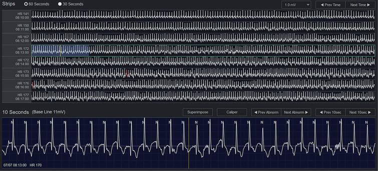 Drivers Qrs diagnostics