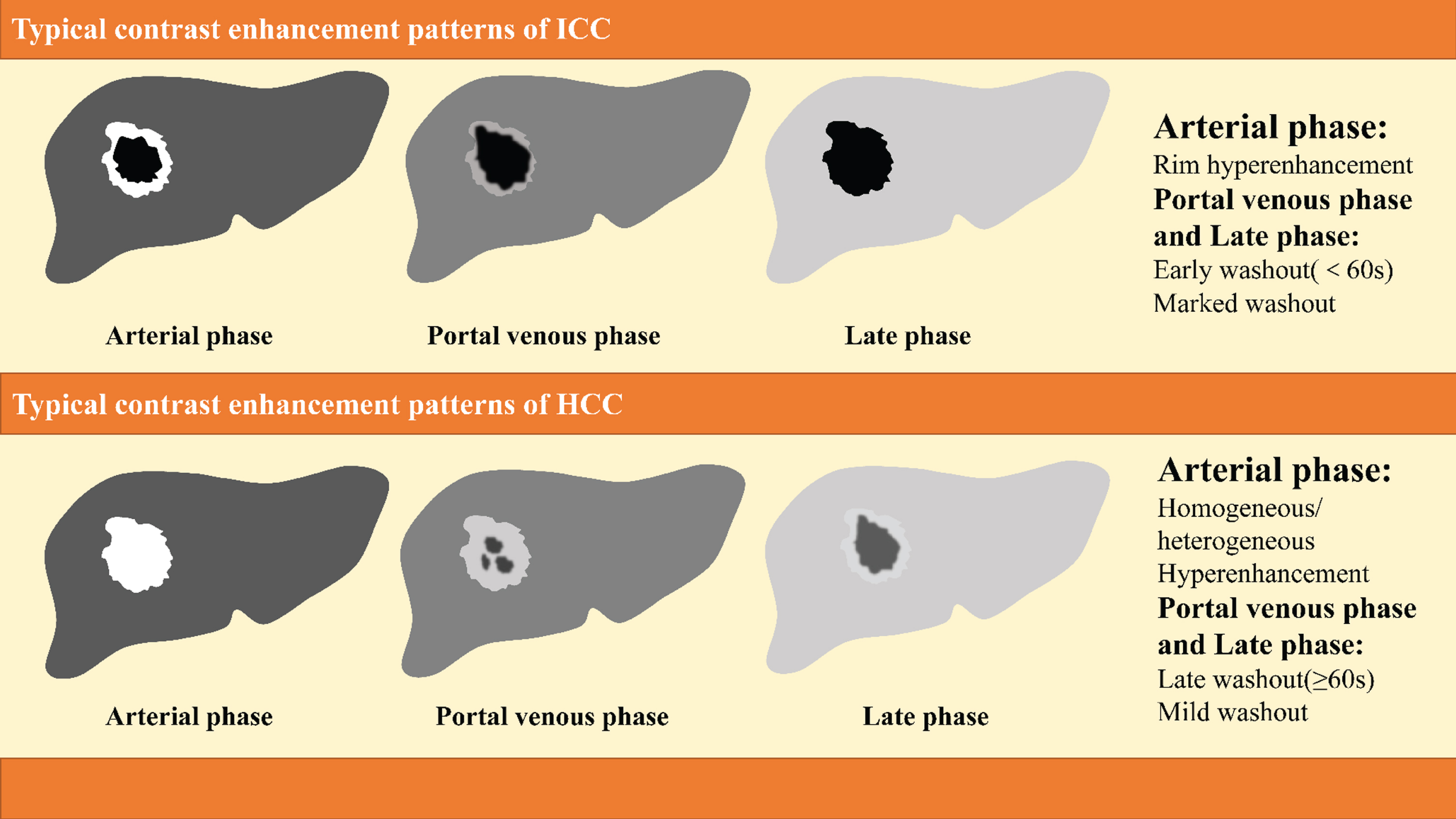 Differentiation Between Hepatocellular Carcinoma And Intrahepatic Cholangiocarcinoma Using