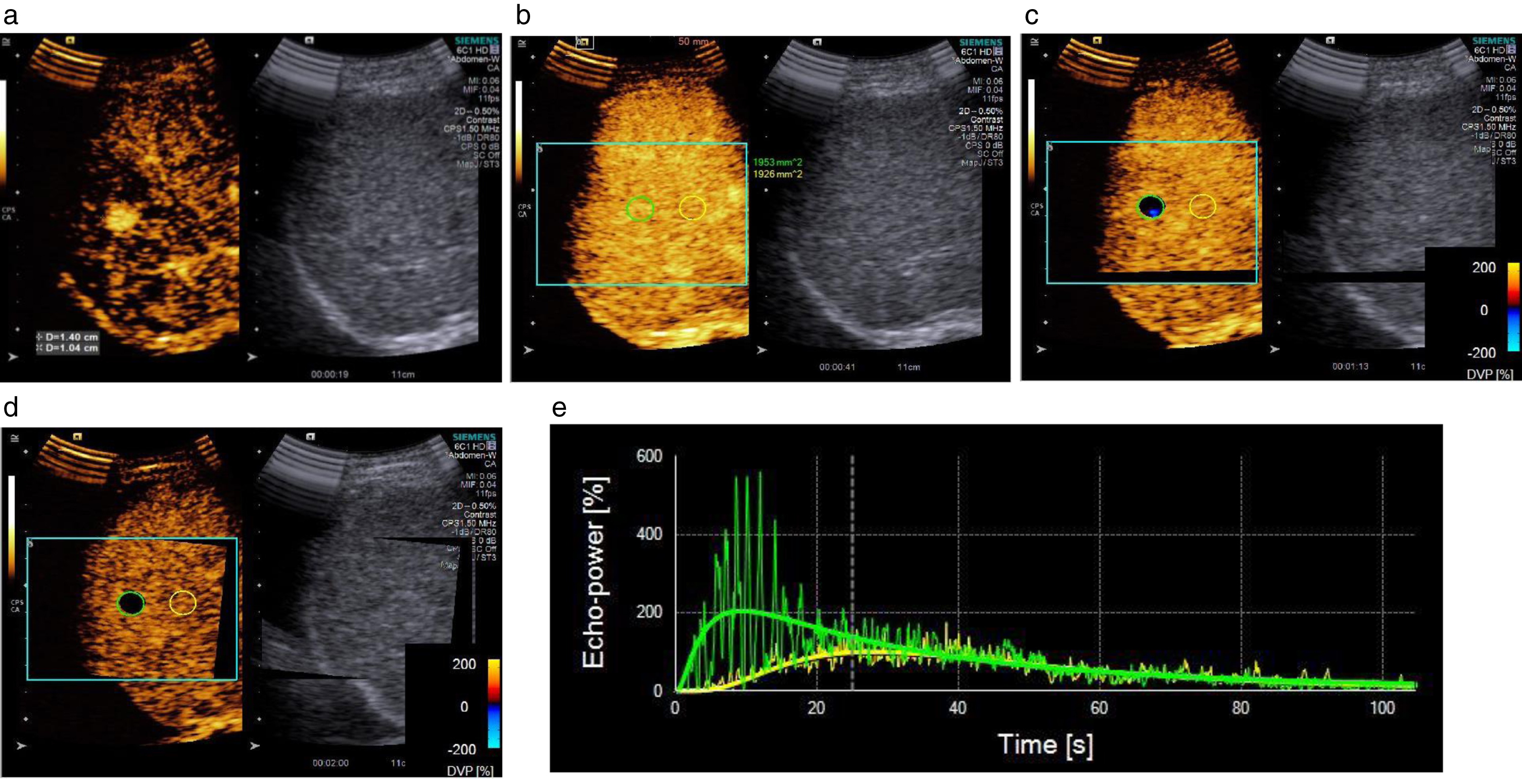 VueBox ® for quantitative analysis of contrast-enhanced ultrasound in ...