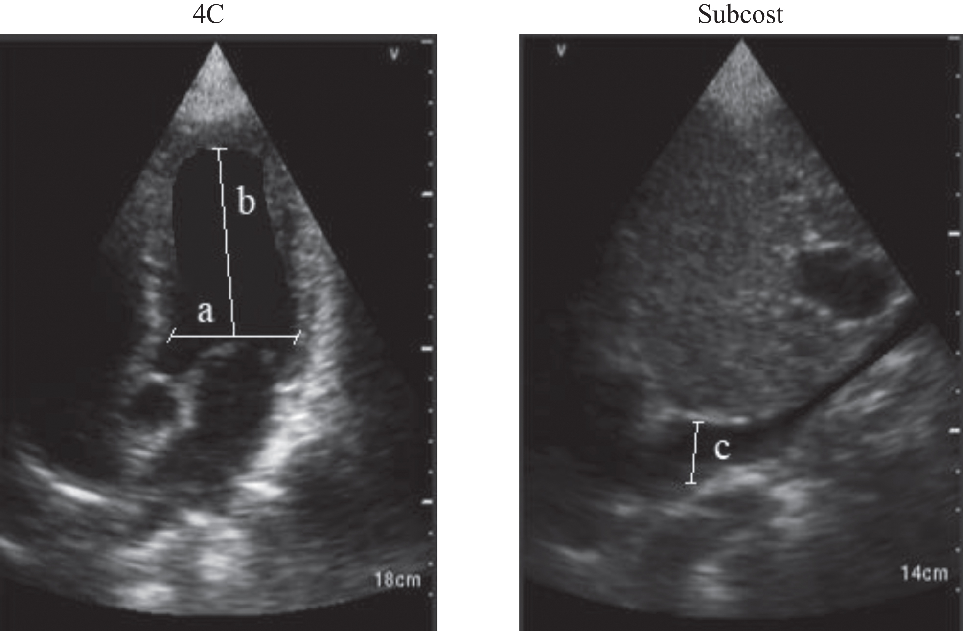 A bedside ultrasound protocol to the measurement of the systemic ...