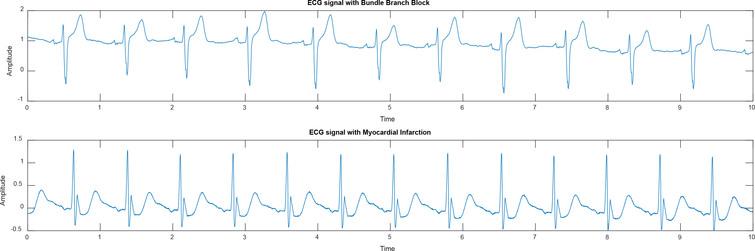 An intelligent medical decision support system for diagnosis of heart ...