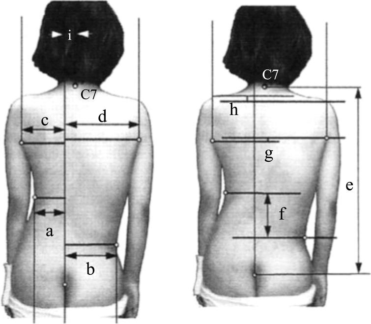 3d model pressure sensor cost low Automatic scoliosis using screening idiopathic