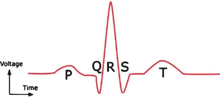 ECG arrhythmia classification using modified visual geometry group ...