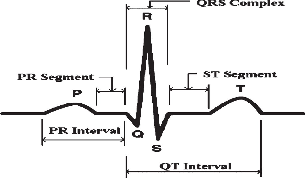 An efficient approach for Paroxysmal Atrial Fibrillation events ...