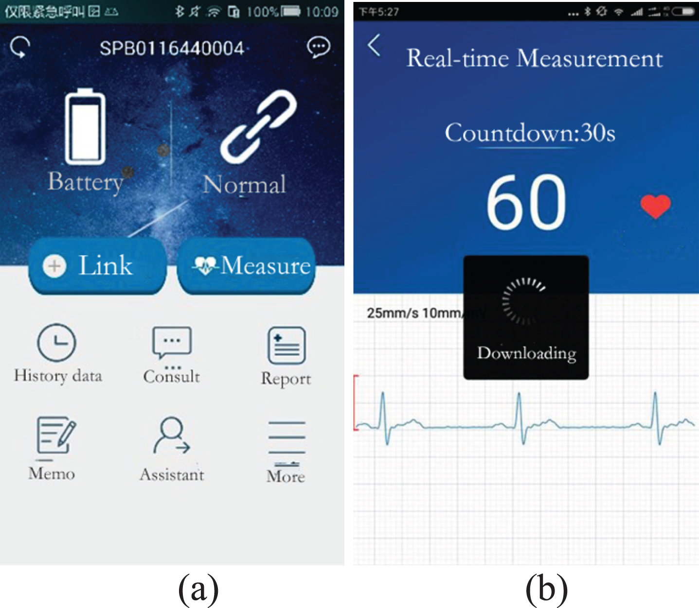 Smartphone Heart Monitor Beats Doctors at Diagnosing Atrial Fibrillation -  IEEE Spectrum