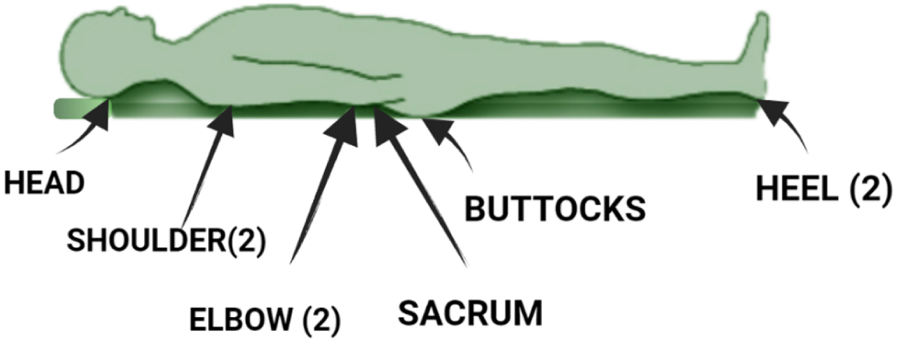 Prediction of internal changes in the sacral region on immobility using ...