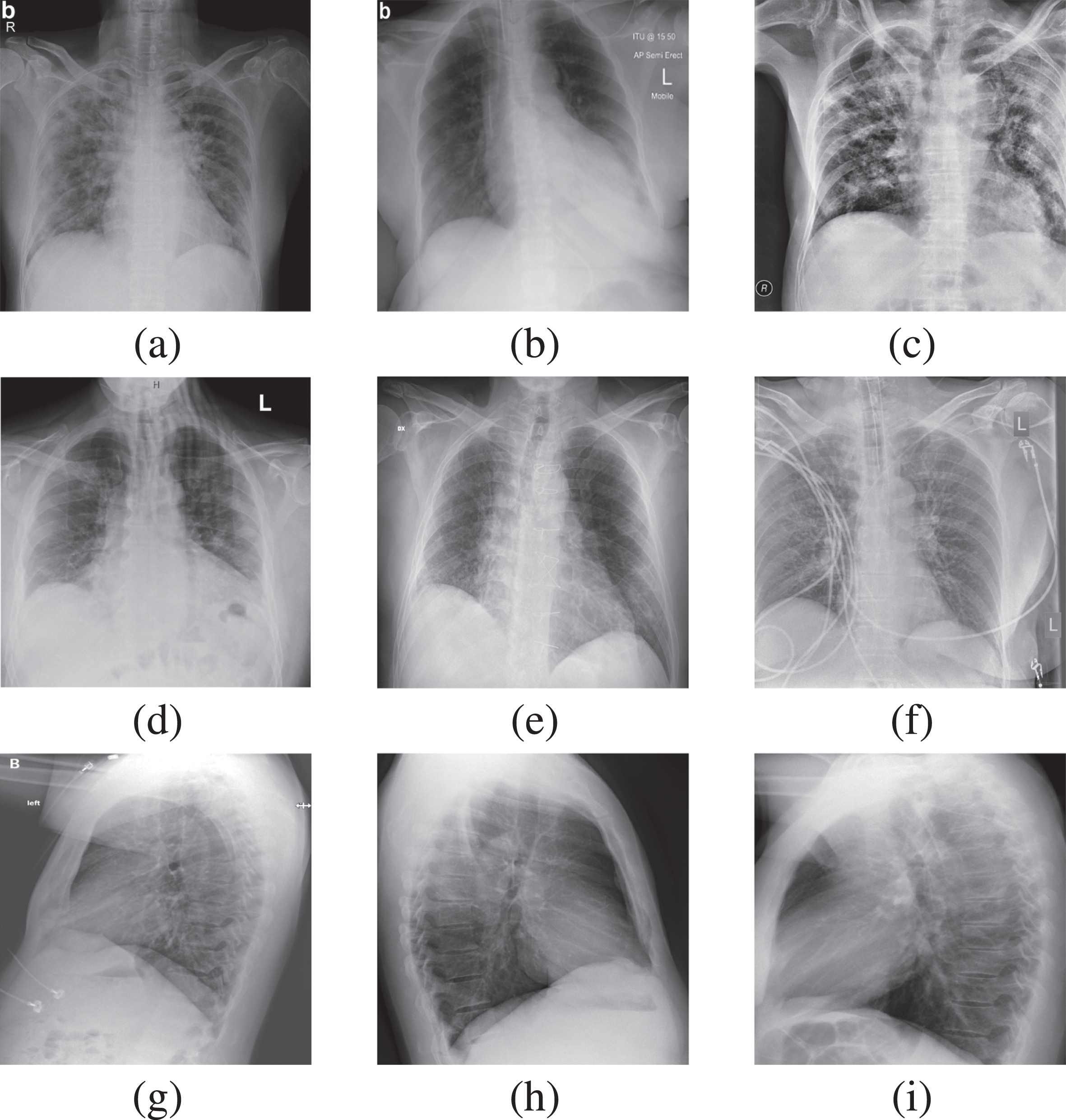 A compact CNN model for automated detection of COVID-19 using thorax x ...