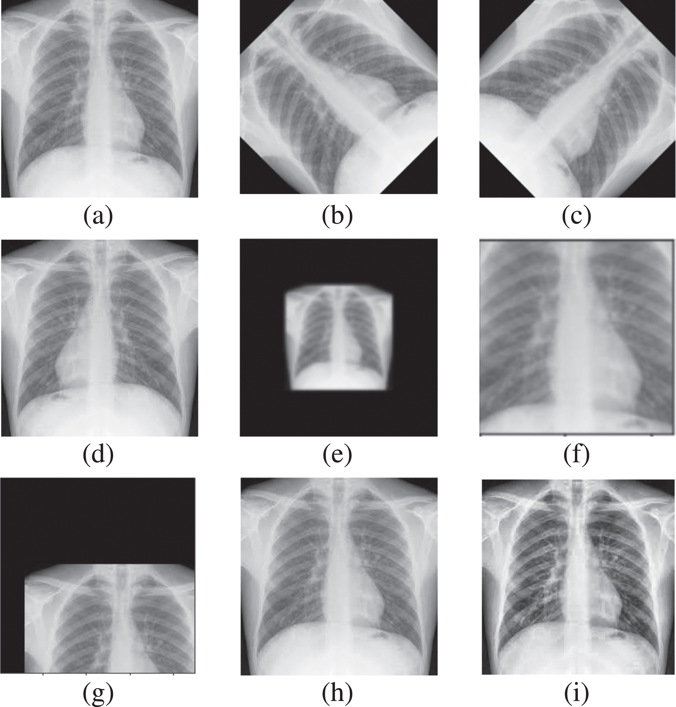 A compact CNN model for automated detection of COVID-19 using thorax x ...