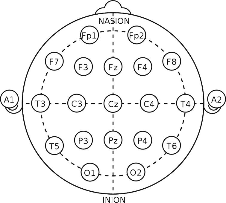 Neurophysiological Assessment of Alzheimer’s Disease Individuals by a ...