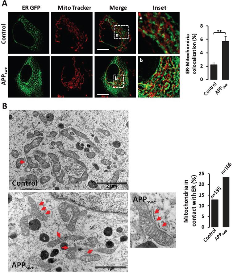 Localization and Processing of the Amyloid-β Protein Precursor in ...