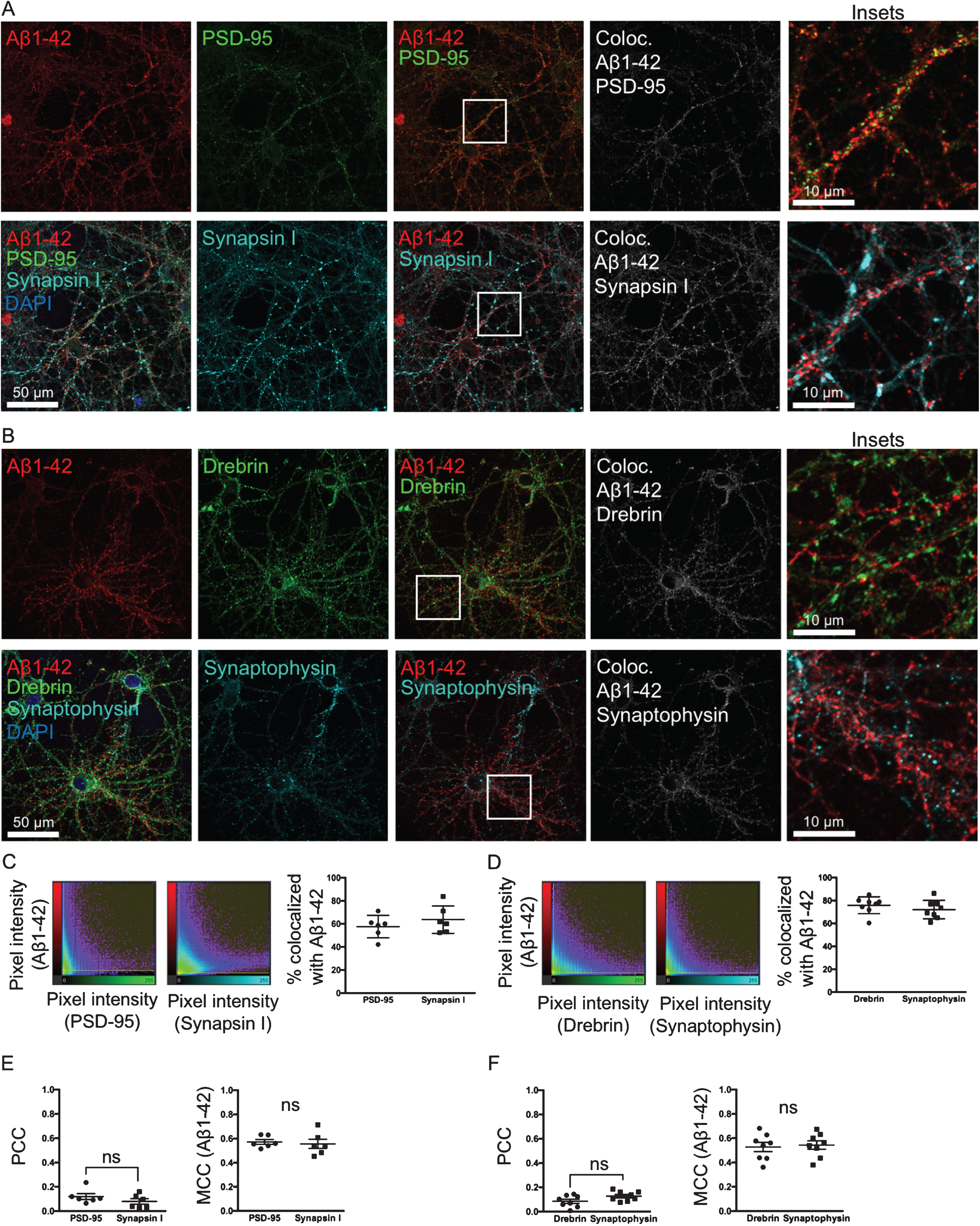 Heterogeneous Association Of Alzheimer’s Disease-Linked Amyloid-β And ...