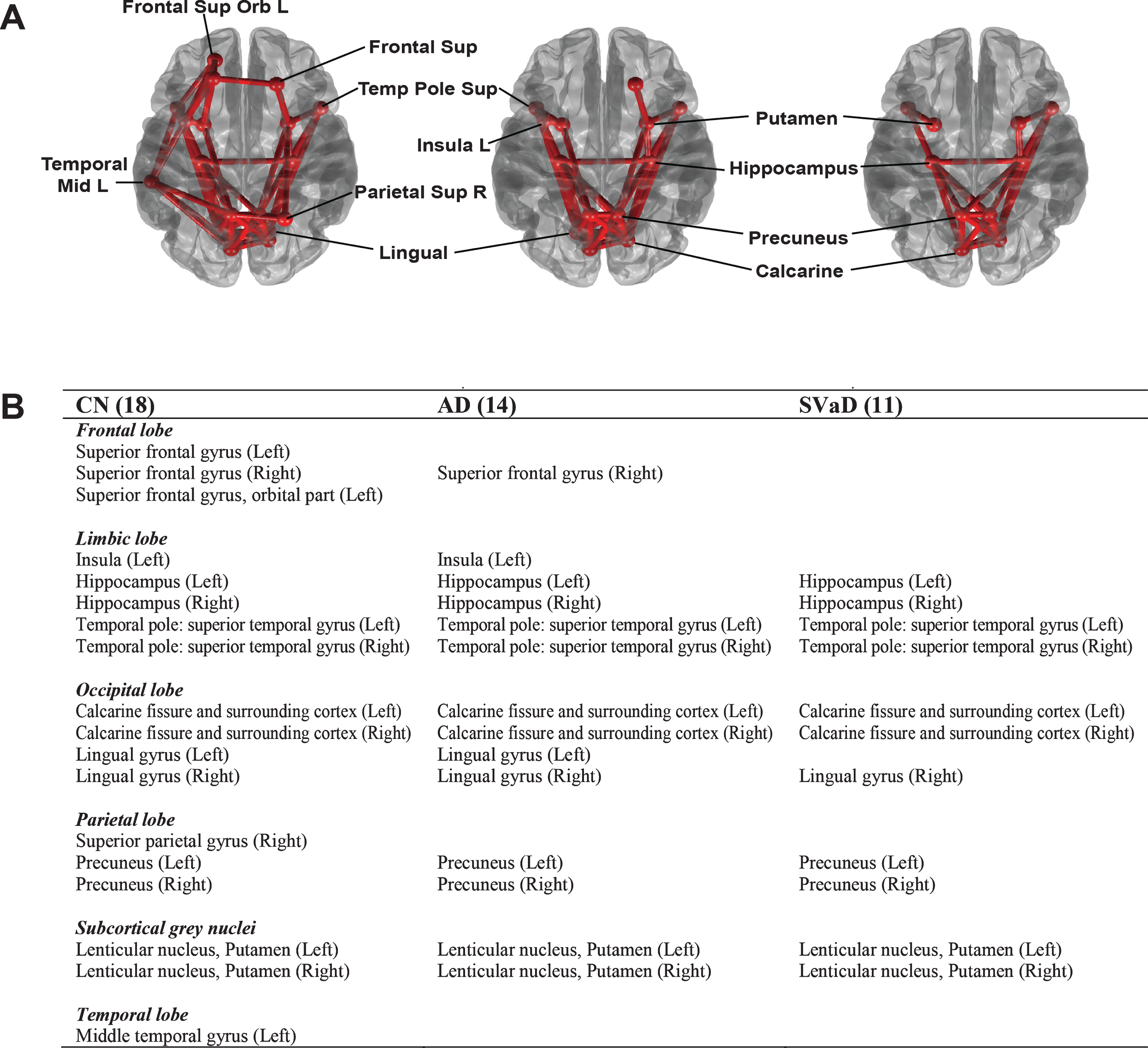 Distinct Patterns Of Rich Club Organization In Alzheimer’s Disease And ...