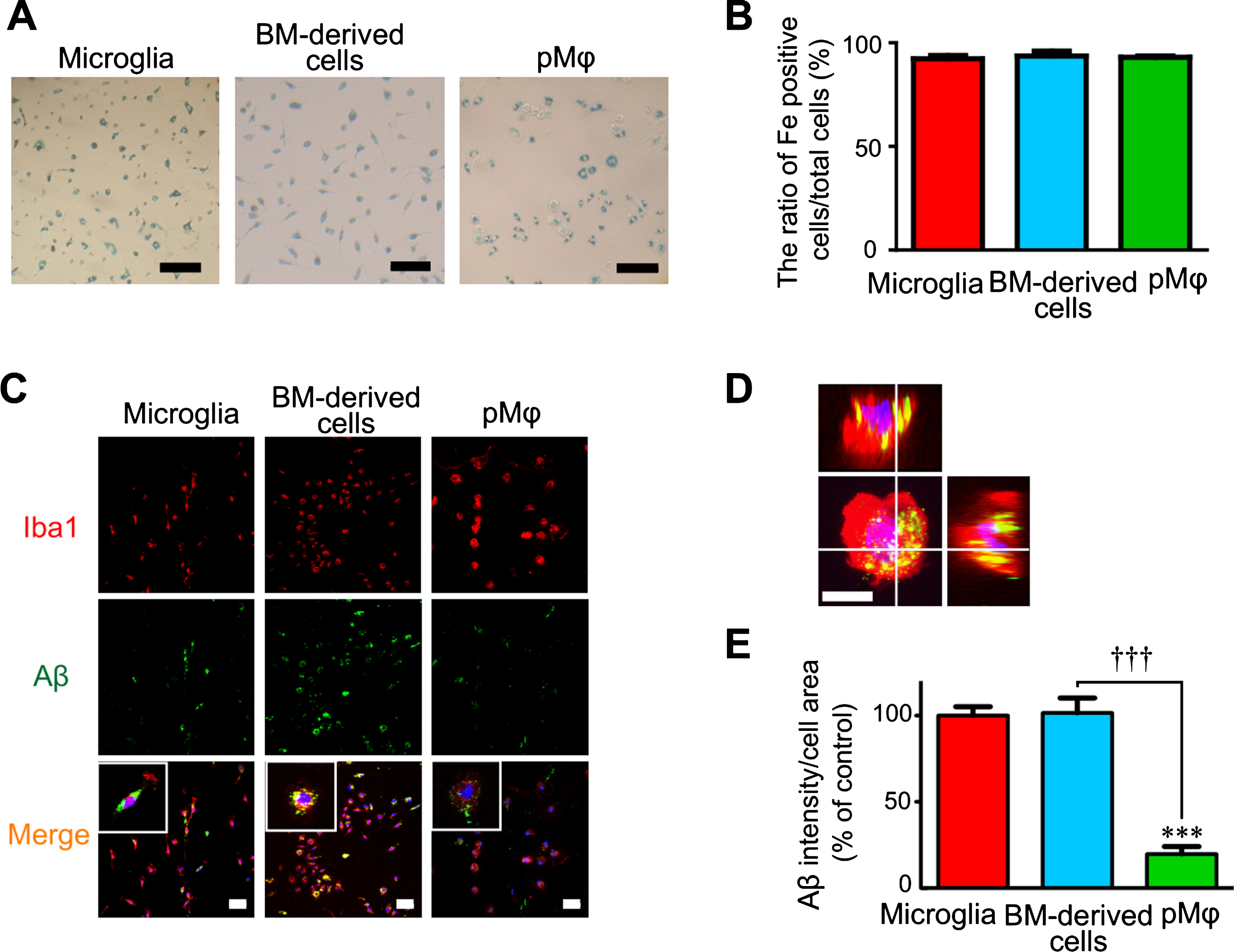 Bone-Marrow-Derived Microglia-Like Cells Ameliorate Brain Amyloid ...