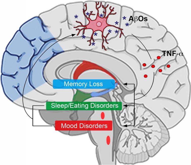 Brain Inflammation Connects Cognitive And Non Cognitive - 