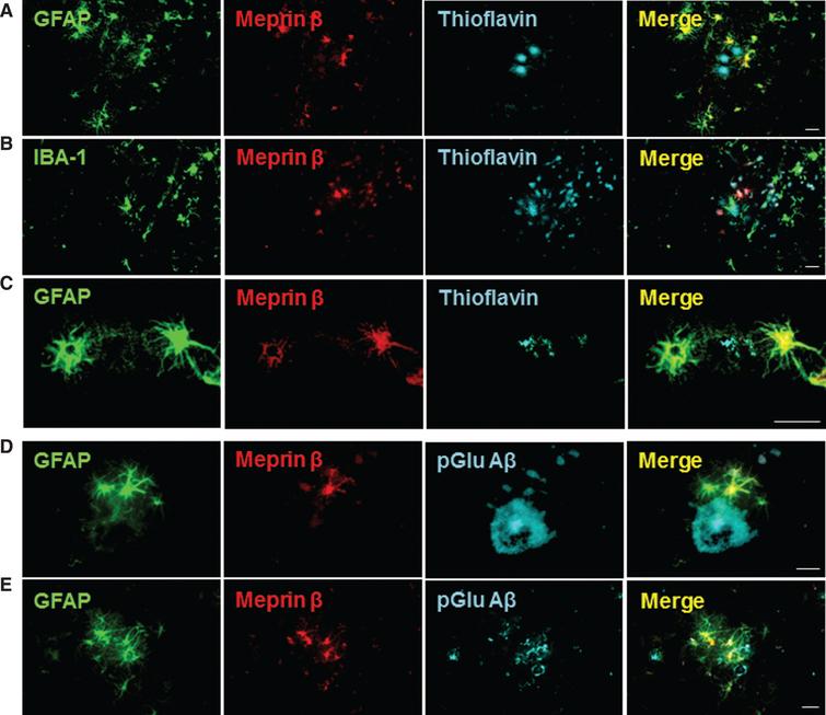 Dipeptidyl Peptidase Activity Of Meprin B Links N Truncation Of Ab With Glutaminyl Cyclase Catalyzed Pglu Ab Formation Ios Press