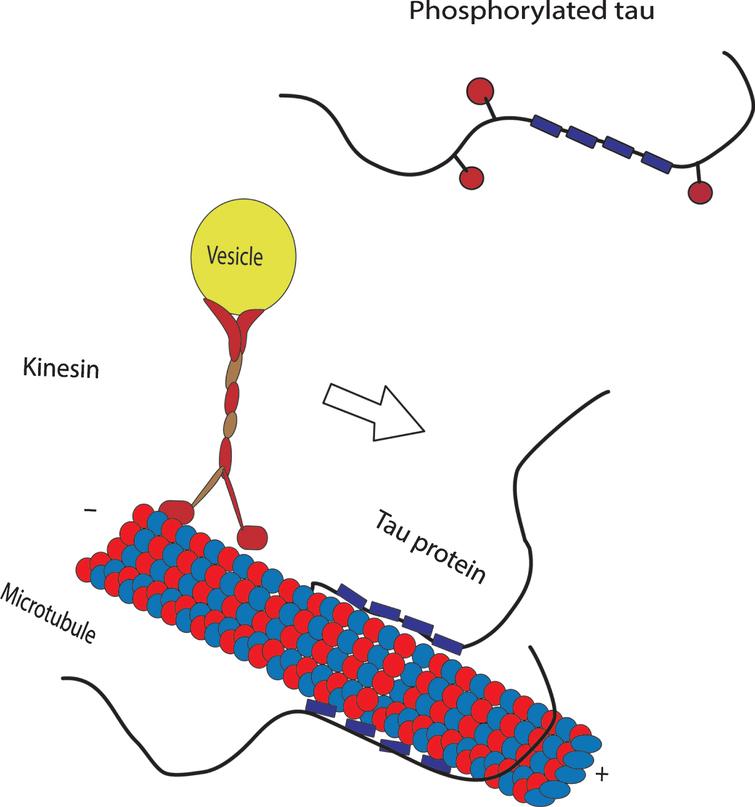 Tau Abnormalities And The Potential Therapy In Alzheimers Disease