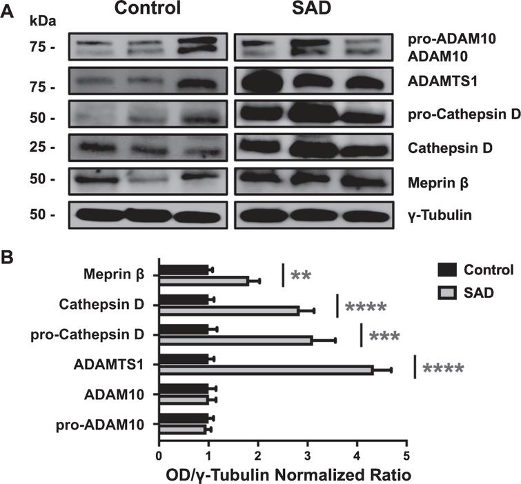 Proteases Upregulation In Sporadic Alzheimer S Disease Brain Ios Press