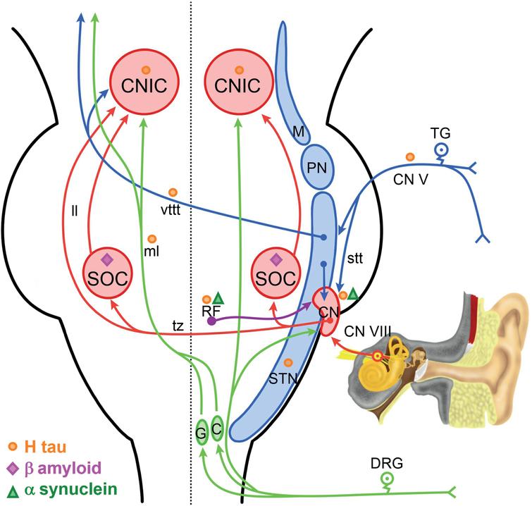 Increased Gain in the Auditory Pathway, Alzheimer’s Disease Continuum ...